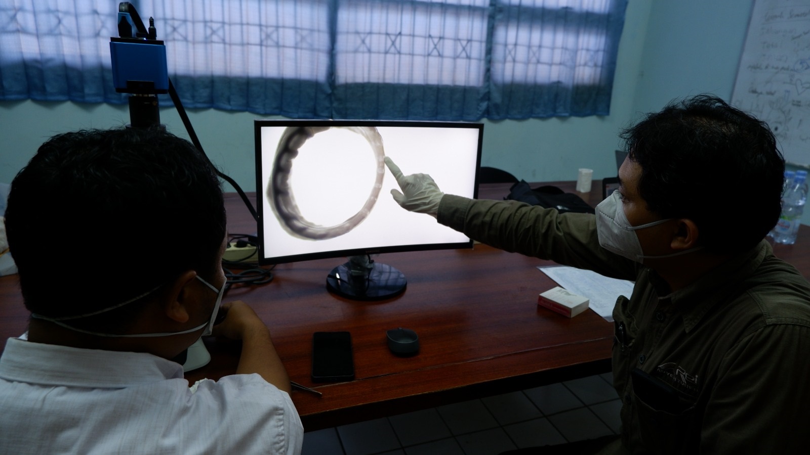 Menghitung gigi tajam pada cincin tentakel pengisap cumi-cumi